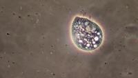 High mag ciliate